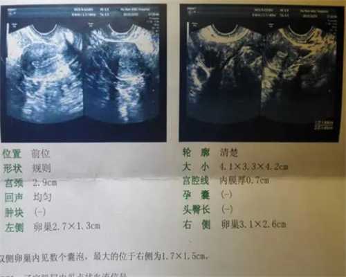 世纪专业代妈_aa69价格,北京供卵试管中心,供卵和普通试管成功率-试管婴儿做两